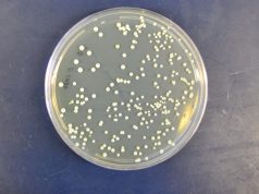 Piccolo database dei lieviti by BrewingBad